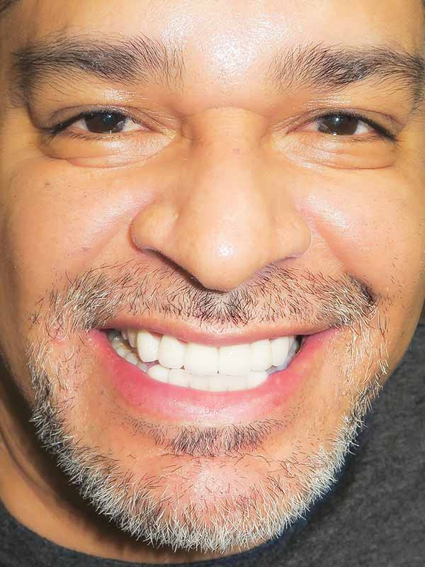 hamlin dental group patient smile after treatment