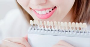 Read more about the article What are Dental Veneers?
