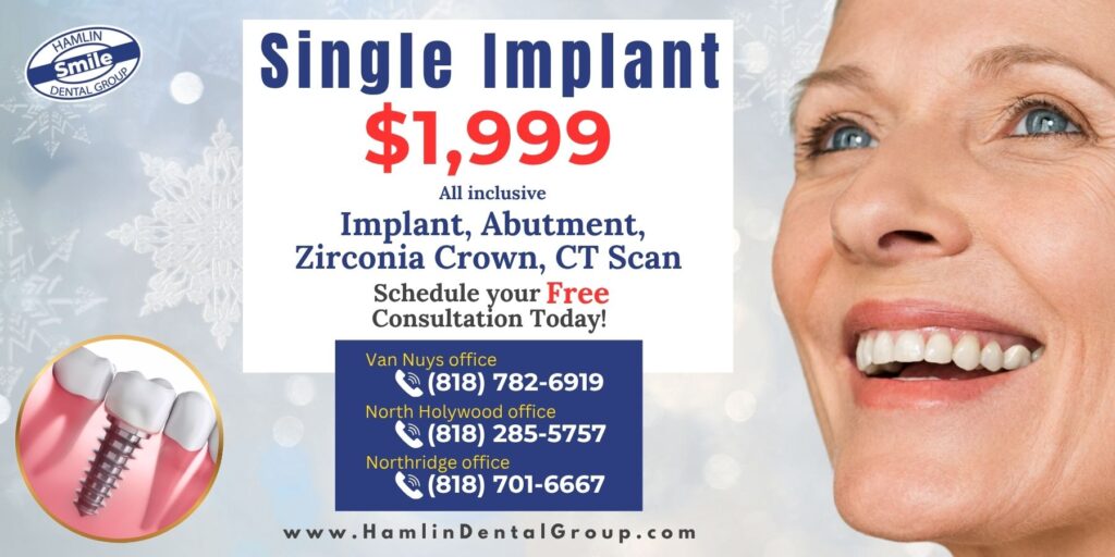 Implant promotion for only $1,999