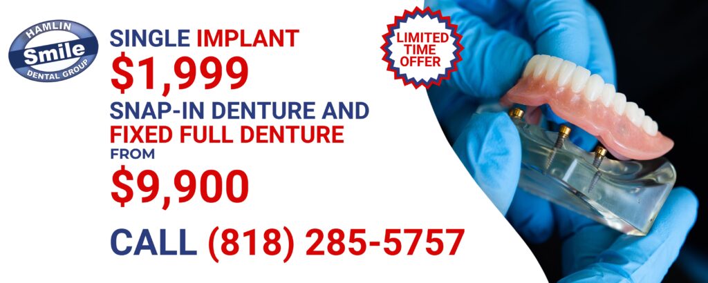 Implant and Full Arch denture special price