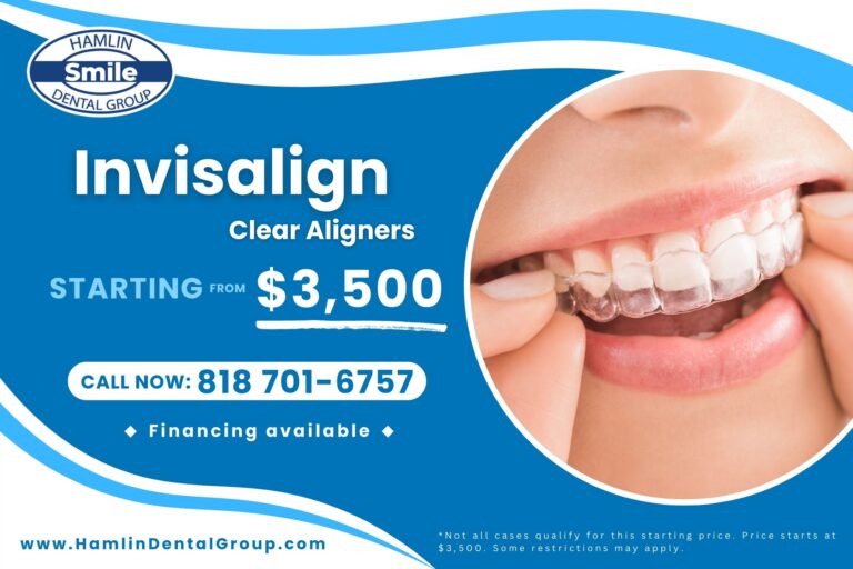 Invisalign Northridge