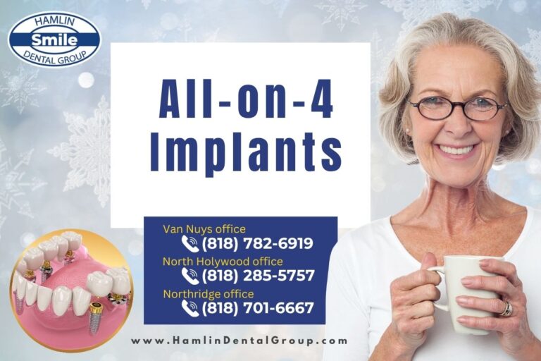 All on 4 implants in Los Angeles
