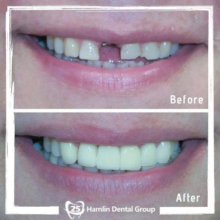 Cosmetic Dentistry Hamlin Dental Group